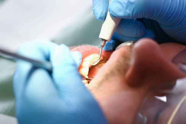 Best Weekend Emergency Dentist in Jackson, MO